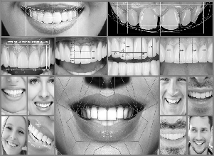Root Canal Treatment